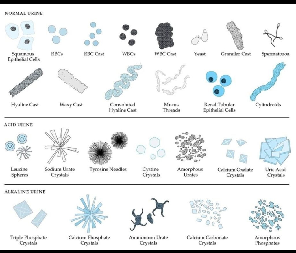 microscopic examination of urine