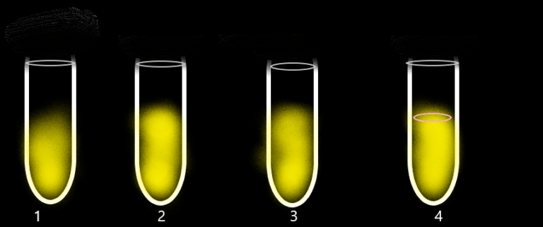 occult blood in urine