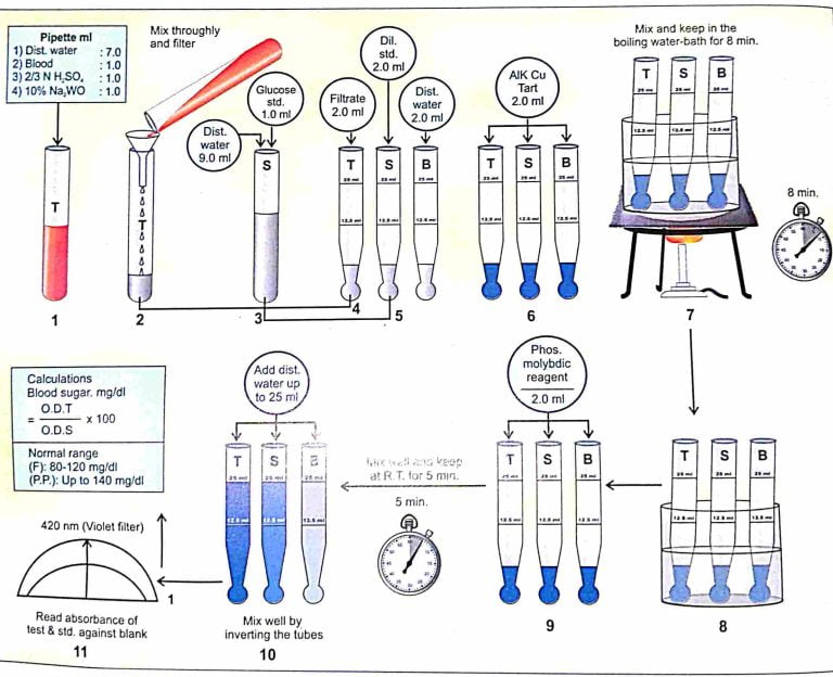BLOOD SUGAR BY FOLIN- WU'S METHOD