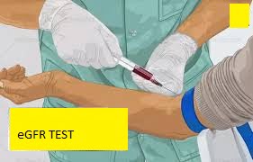 eGFR TEST