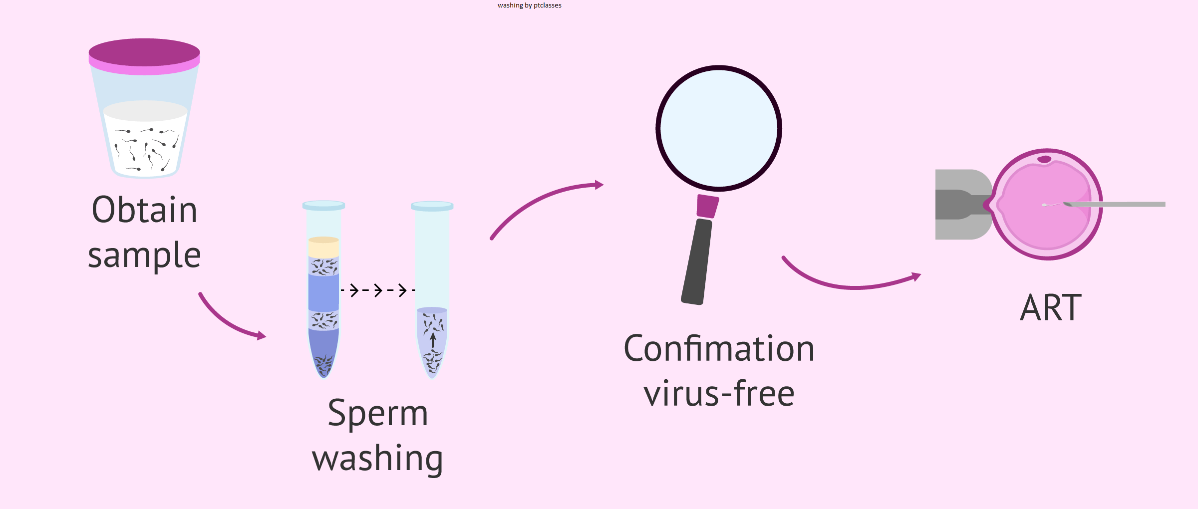 sperm washing
