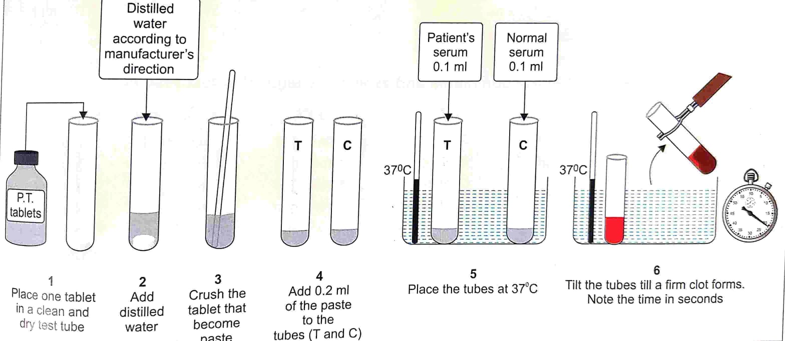 prothrombin time