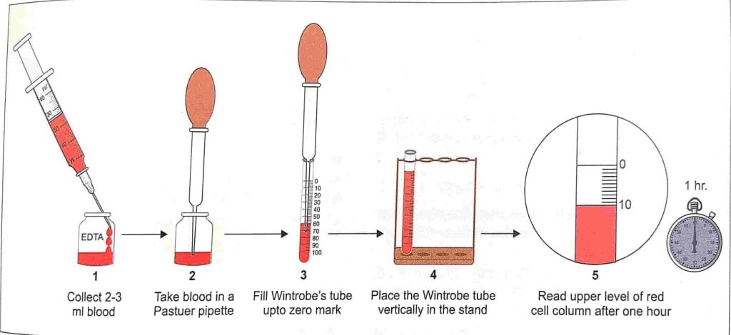 erythrocyte sedimentation rate